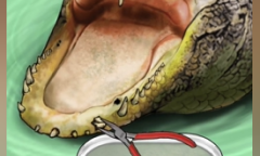 《全民剧本大师》鳄鱼拔牙通关方法