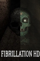 心房颤动HD