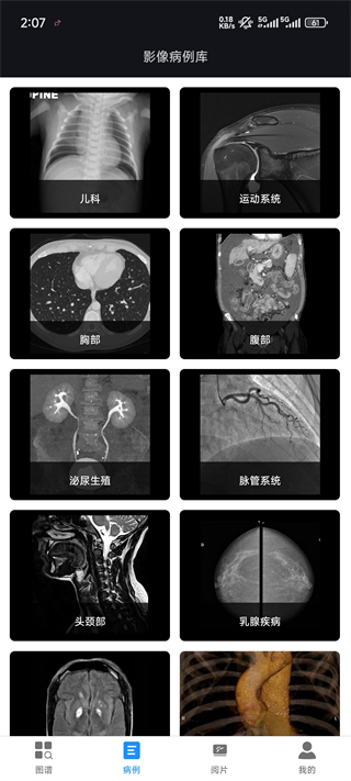 影像解剖图谱app